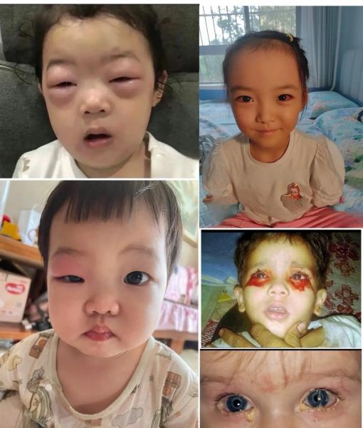 经常玩手机会怎么样_眼睛会瞎吗-第2张图片-俊逸知识馆